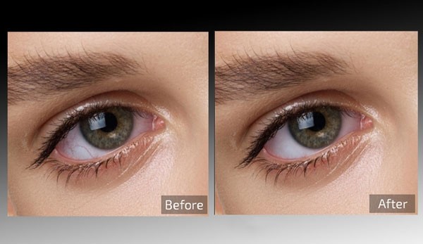 Retouch4me Eye Vessels